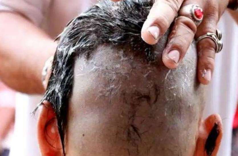 20_04_2020-mundan_demo1.jpg नगर निगम ने बढ़ाया हाउस टैक्स तो विरोध में उतरे लोग, पार्षद ने मुंडन करा कर जताया विरोध