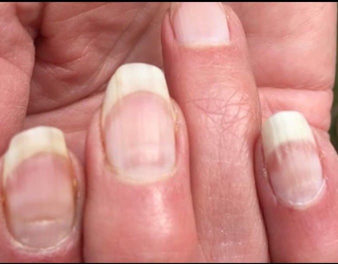 covid_nails.jpg