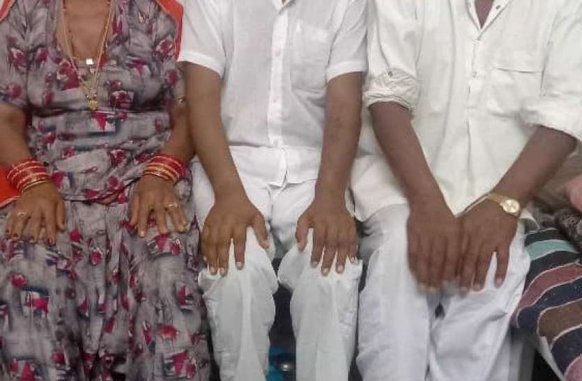 Father's Day: किडनी का दान देकर 634 पिता ने बचाई बच्चों की जान Father's Day: किडनी का दान देकर 634 पिता ने बचाई बच्चों की जान