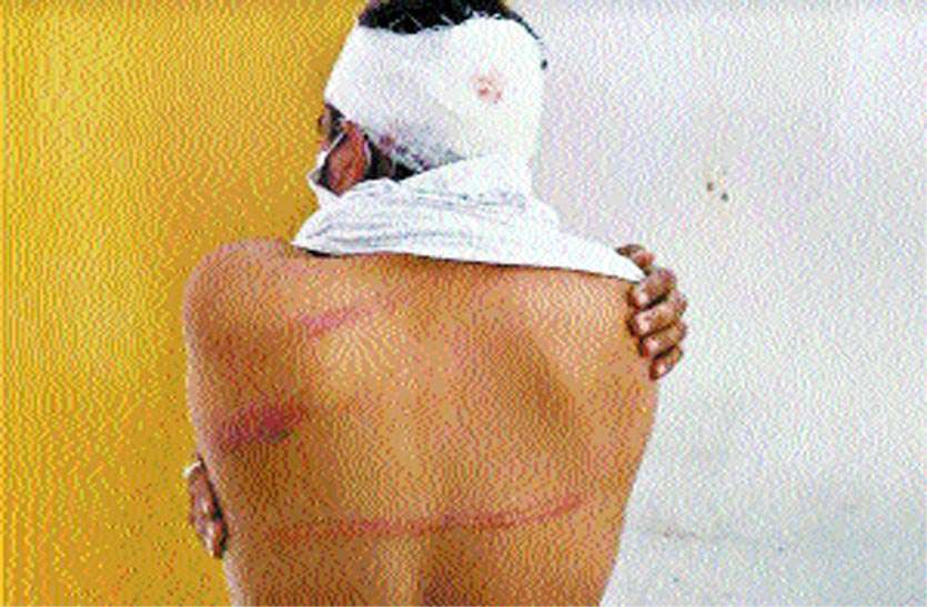 बजरी माफियाओं का हमला, दो पुलिसकर्मी घायल बजरी माफियाओं का हमला, दो पुलिसकर्मी घायल
