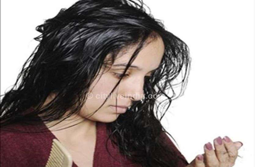 Hair fall solution Health Tips: बालों का गिरना, खुजली और डैंड्रफ जैसी समस्याओं से ऐसे पाएं छुटकारा, अपनाएं ये घरेलु नुस्खे