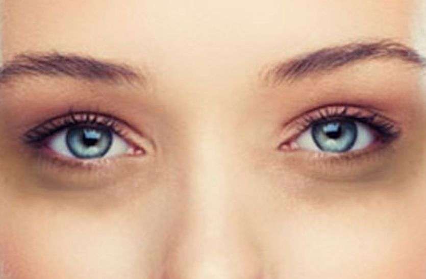 Dark Circles Dark Circles :- बरसों पुराने डार्क सर्कल भी होंगे इन घरेलू उपाय से कुछ दिनों में दूर