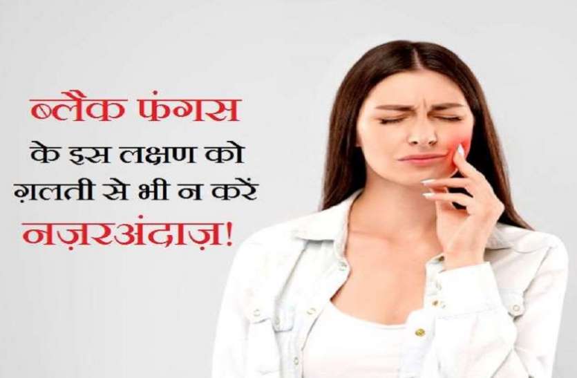 दातों में दर्द हो तो फौरन करें डॉक्टर से परामर्श दातों में हो दर्द तो न लें हल्के में, ब्लैक फंगस भी हो सकता है