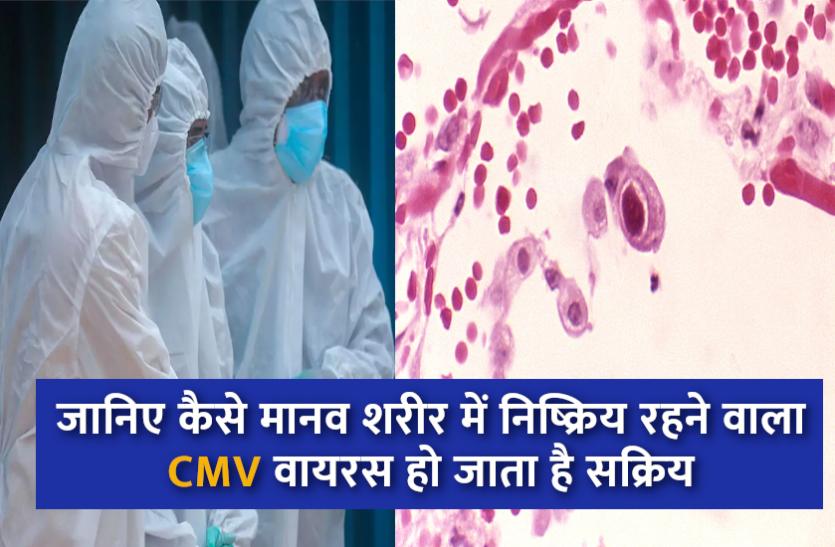 कोविड से उबरे मरीज अब साइटोमेगालोवायरस से परेशान कोविड से उबरे मरीज अब साइटोमेगालोवायरस से परेशान