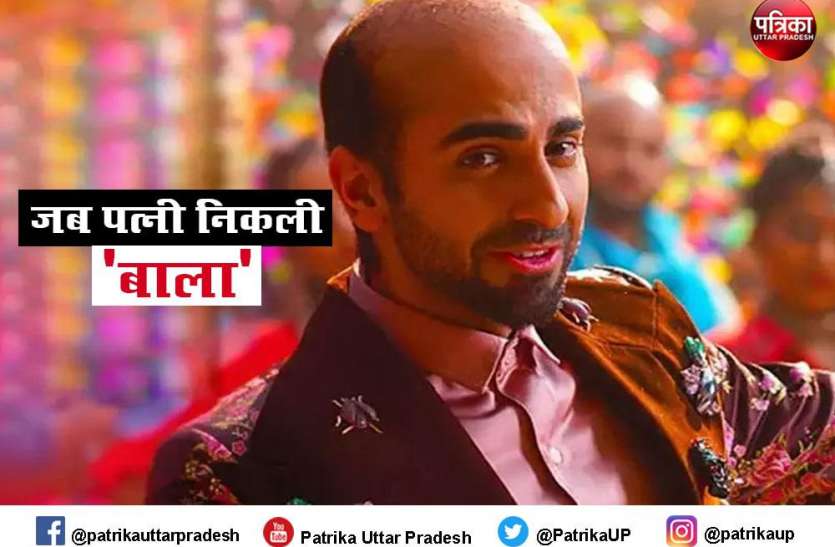 Bald wife शादी के कुछ ही दिन बाद पत्नी की खुली पोल, नहीं थे सर पर एक भी बाल, पति के उड़े होश
