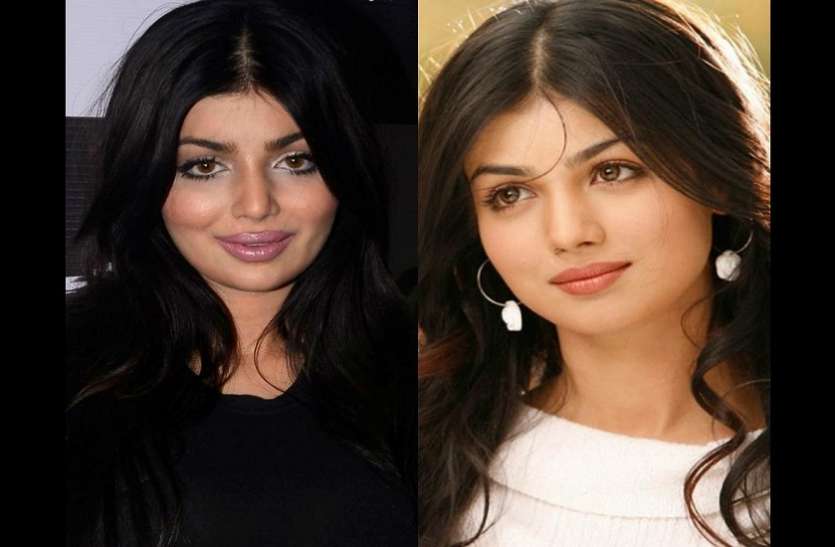 Ayesha Takia Trolled On Social Media For Her Lip Surgery