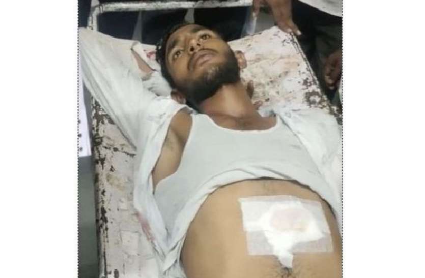 किशोर के दो गोली लगी, एक निकली, एक लीवर में धंसी किशोर के दो गोली लगी, एक निकली, एक लीवर में धंसी