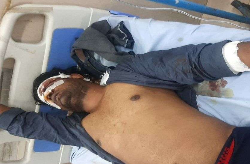 कोटा के एमबीएस अस्पताल में भर्ती घायल युवक कोटा में वारदात : आधा दर्जन बदमाशों ने कार सवार युवक पर किया लाठियों व सरियों से हमला, 48 हजार रुपए व मोबाइल लूटा