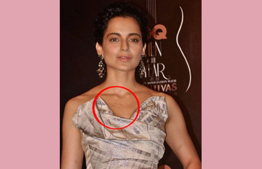 love_bite_kangana_ranaut.png