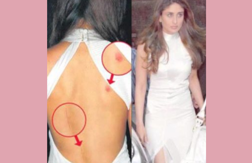 love_bite_kareena_kapoor.png