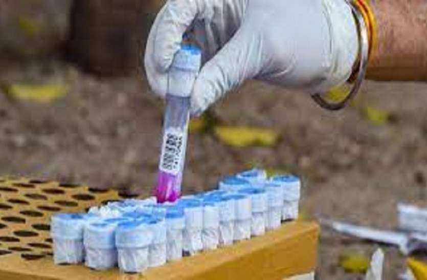 testing kit कोरोना टेस्ट अब घर पर होना मुमकिन, आईसीएमआर ने तीन किटों को दी मंजूरी