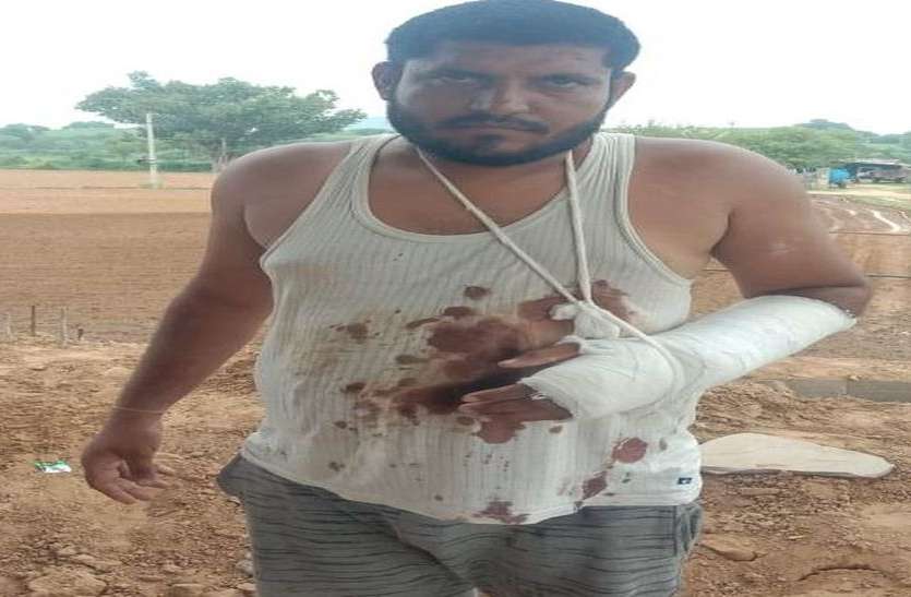 सरपंच पति पर की फायरिंग, बाएं हाथ में लगी गोली सरपंच पति पर की फायरिंग, बाएं हाथ में लगी गोली