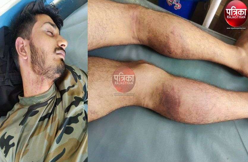होटल संचालक और कांस्टेबल ने युवक को बेरहमी से पीटा होटल संचालक और कांस्टेबल ने युवक को बेरहमी से पीटा