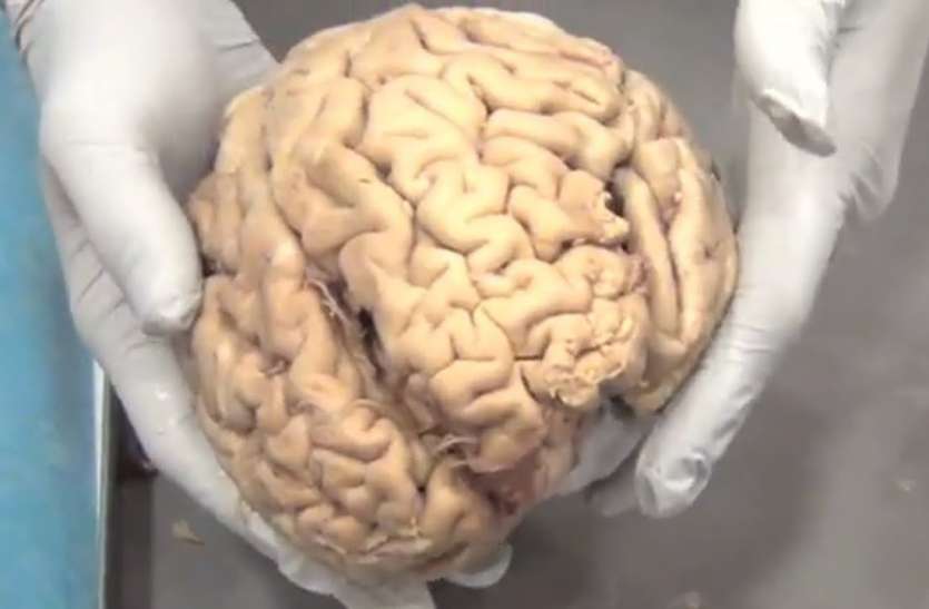 World Alzheimer Day 2021: Five Worst Foods for your Brain World Alzheimer's Day 2021: ब्रेन के लिए बेहद खराब होते हैं ये पांच फूड, आज से ही कम कर दें खाना