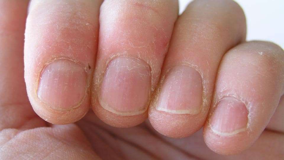 bad_nails.jpg