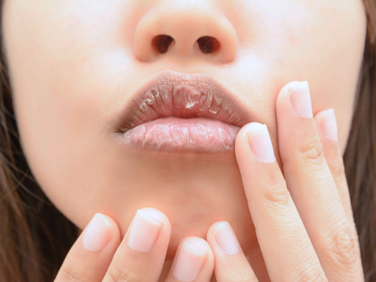 Things to add in your diet for hydrated lips
