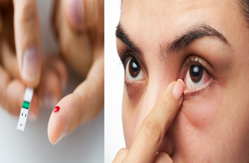 किडनी और आंखों पर गंभीर असर डाल सकती है टाइप 2 डायबिटीज, दिखें ऐसे लक्षण तो न करें अनदेखा