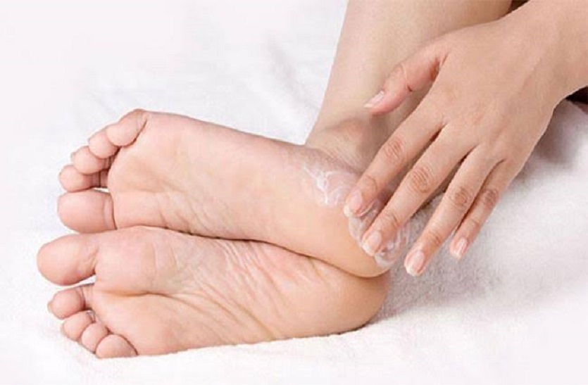 home remedies for  cracked heels