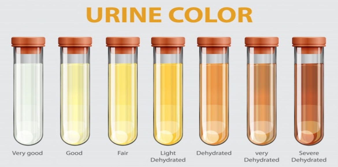 urine_color.jpg