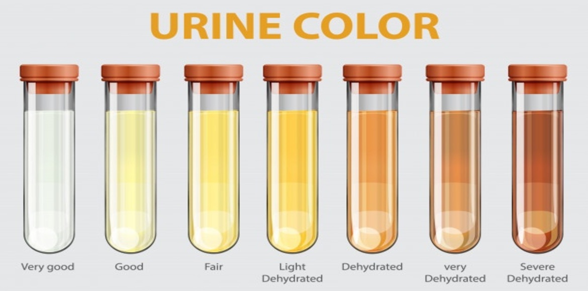 urine-colors-indicates-your-health-condition