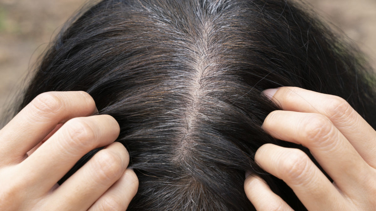 Does Pulling One Gray Hair Cause More to Grow in its Place  UAMS Health