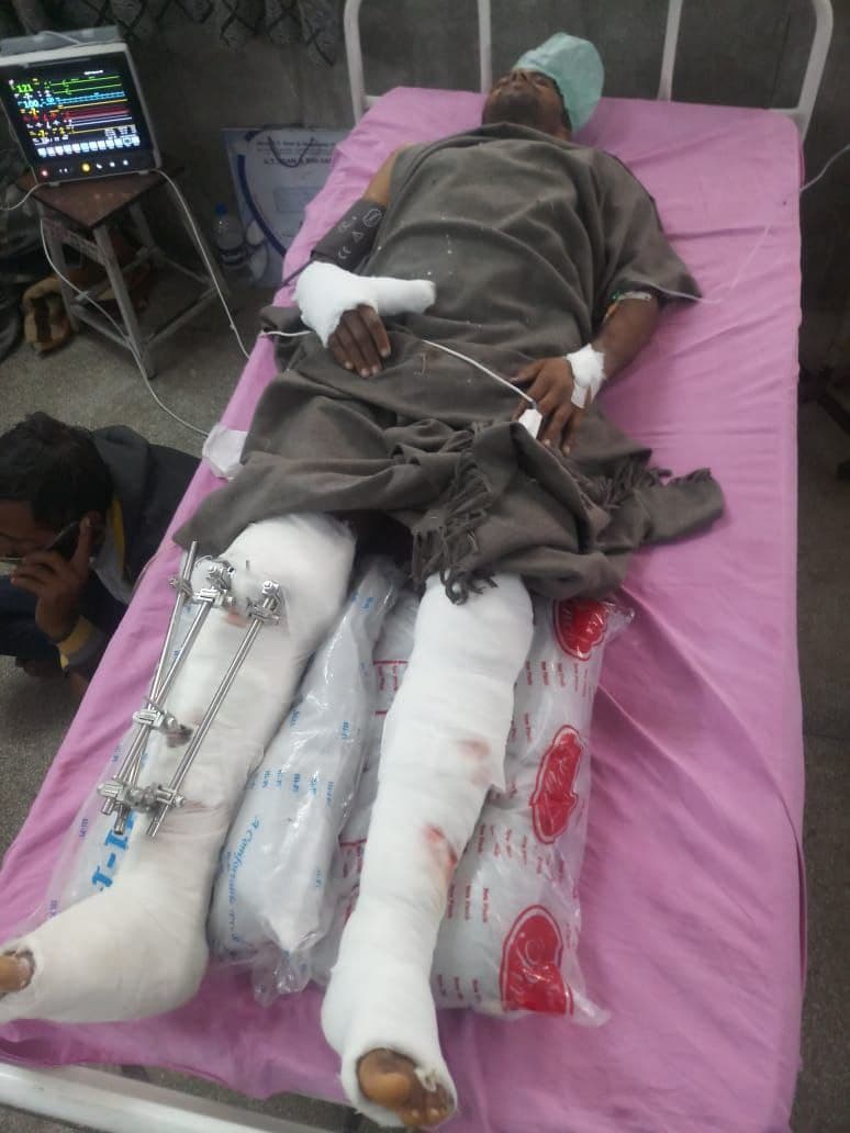 हाथ-पांव टूटने पर नहीं टूटा जितना अमराराम, आज टूटेगा उतना