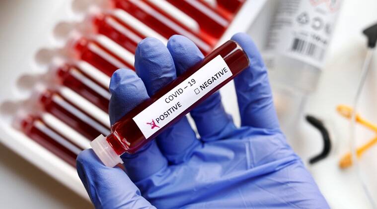 coronavirus-positive-1-759.jpg