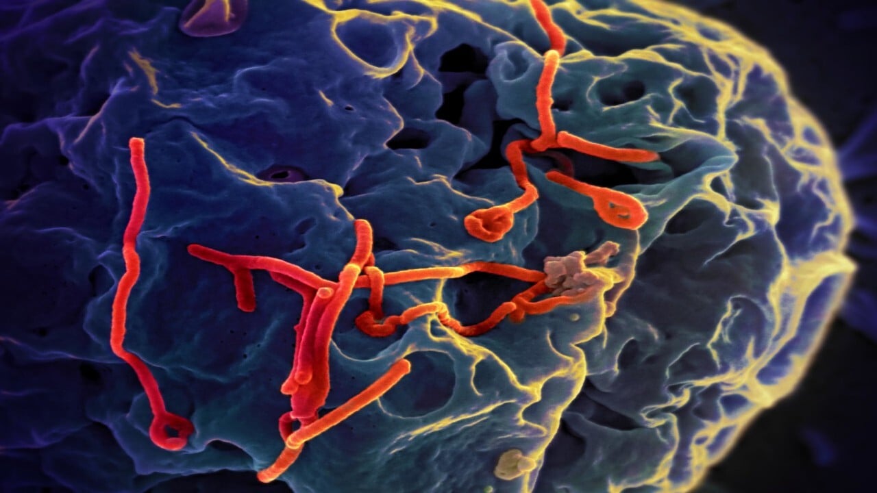 जानें क्या है इबोला वायरस कैसे करता है ये आपके ऊपर असर