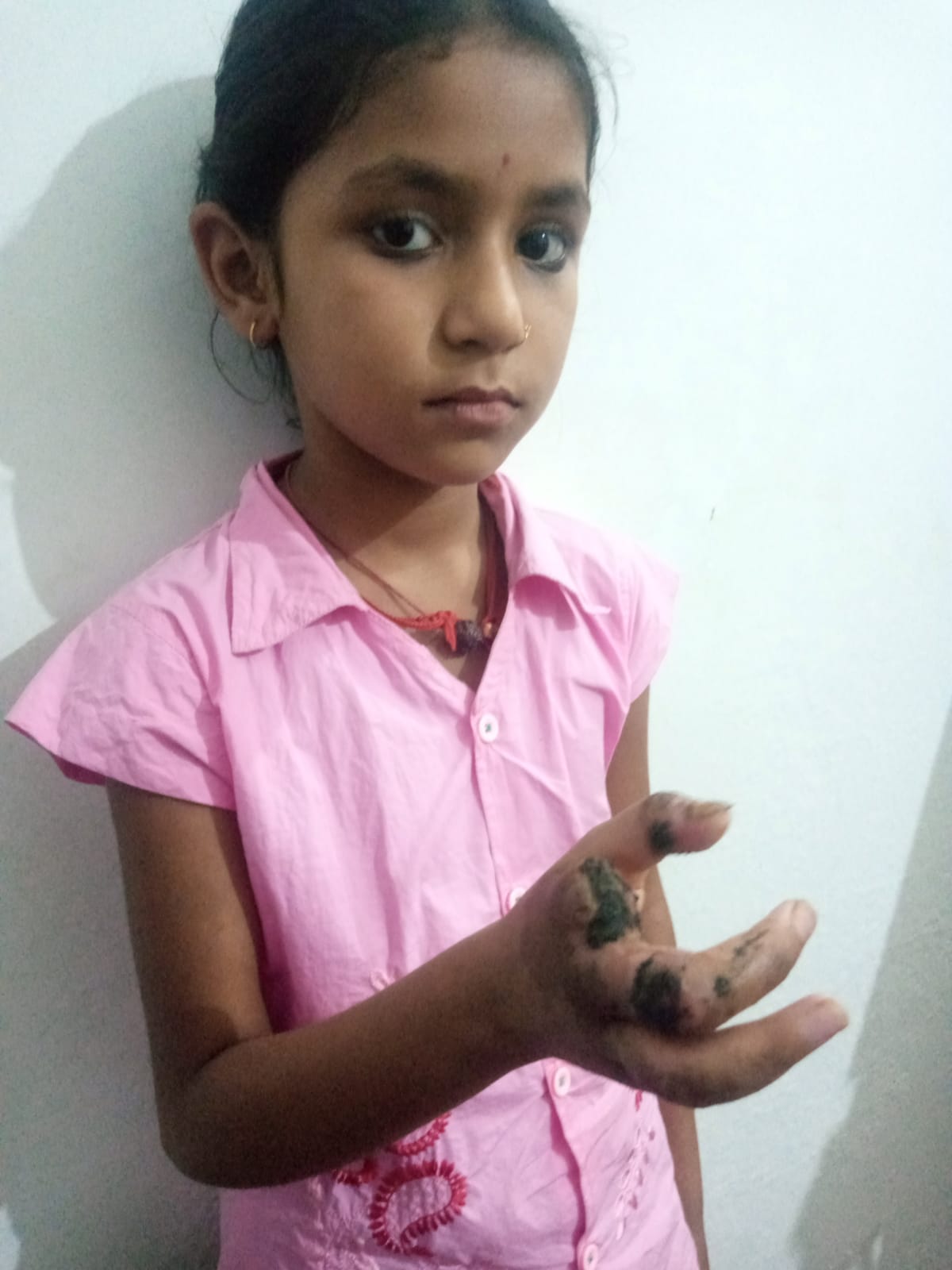 10 Year Old Girls Finger Had To Be Amputated Due To Wrong Treatment