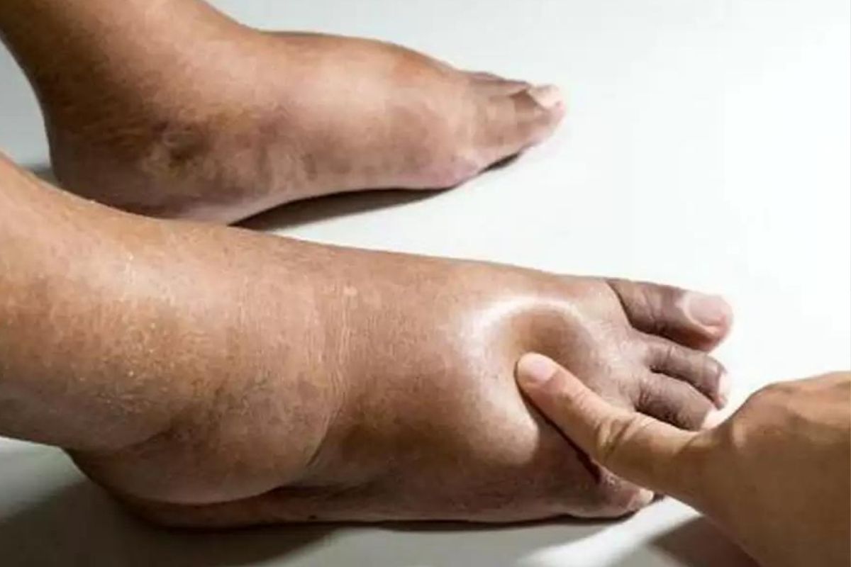 swollen_feet_-_tips_to_reduce_pain.jpg