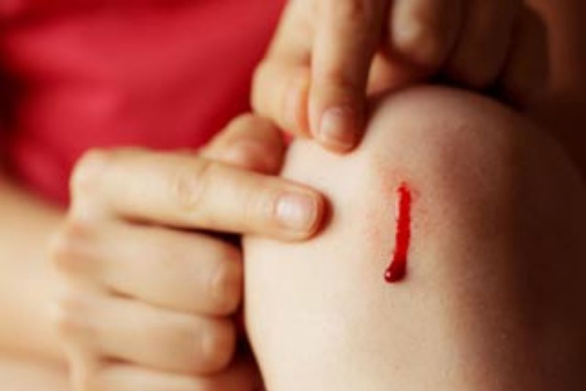 haemophilia_day_these_6_signs_of_non-stop_bleeding_are_symptoms_of_serious_illness.jpg