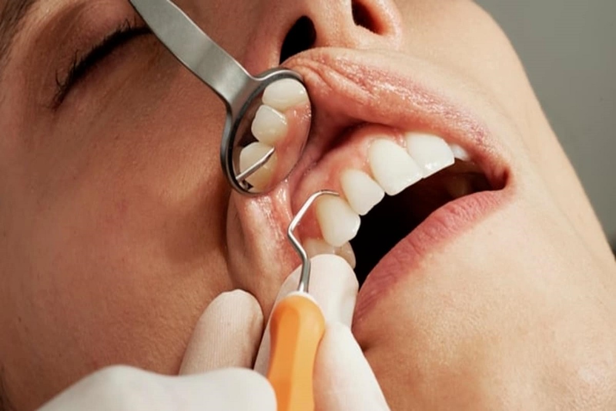 जानिए इन ओरल मिथ्स  के बारे में जो पंहुचा सकते हैं आपके दांतों को नुकसान