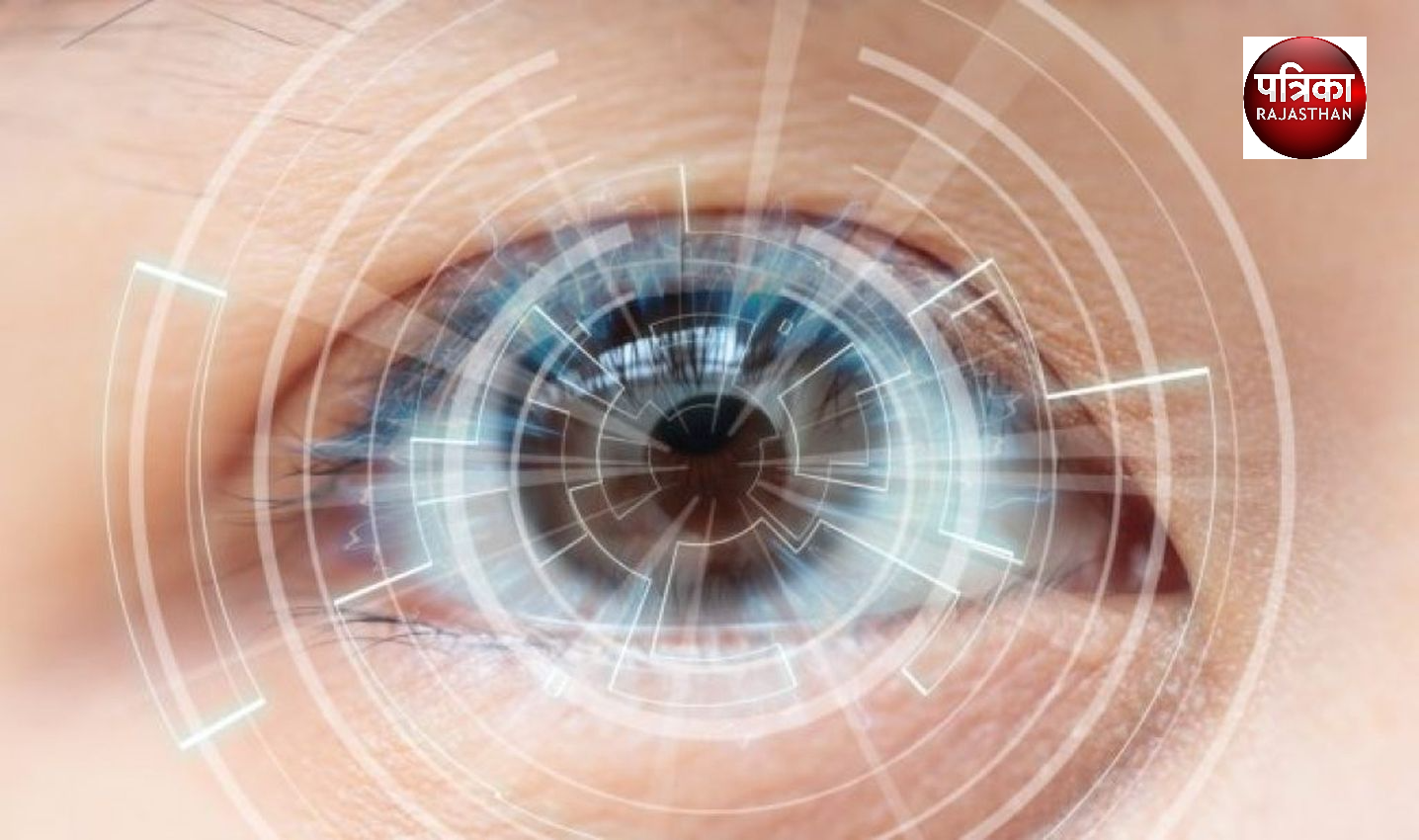 Cataracts - मोतियाबिंद की होगी आसानी से पहचान, IIT जोधपुर ने किया कमाल