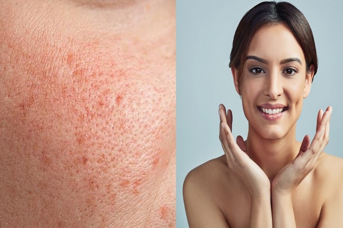 open pores skincare In Bangalore