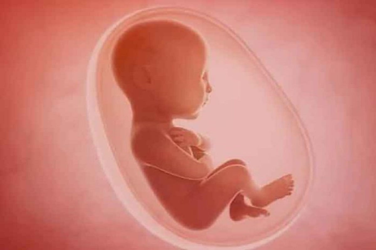डस्टबिन में 5 महीने का भ्रूण मिलने से हड़कंप, STF को देखकर छुप गया डॉक्टर, जानें पूरा मामला