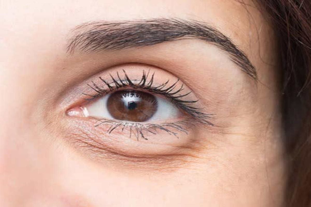 Skin Care Tips: क्या आपकी आंखों के पास लटकने लगी है स्किन, ये घरेलू उपाय दिलाएंगे इससे छुटकारा