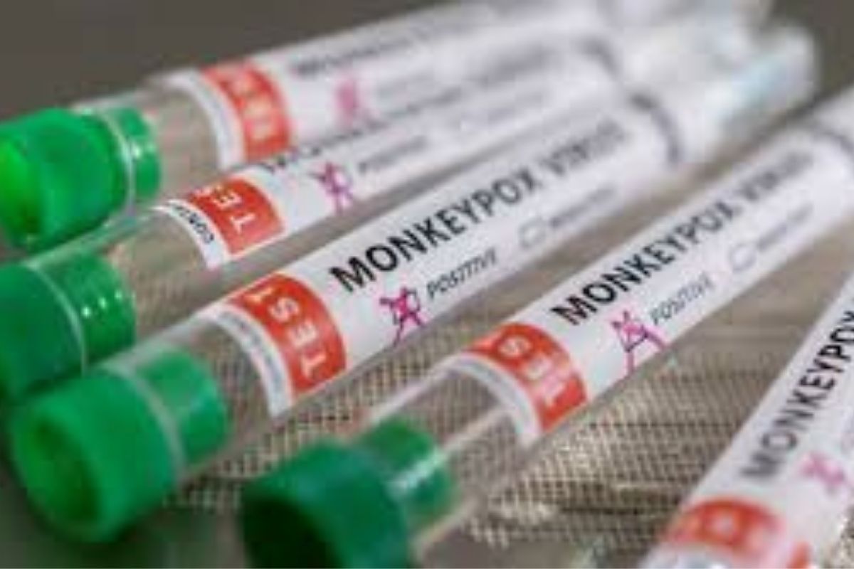 Monkeypox Spreading Reason: मंकीपॉक्स के मरीज के कपड़े और टॉवल से भी फैल सकते हैं वायरस, जानिए कैसे करें बचाव