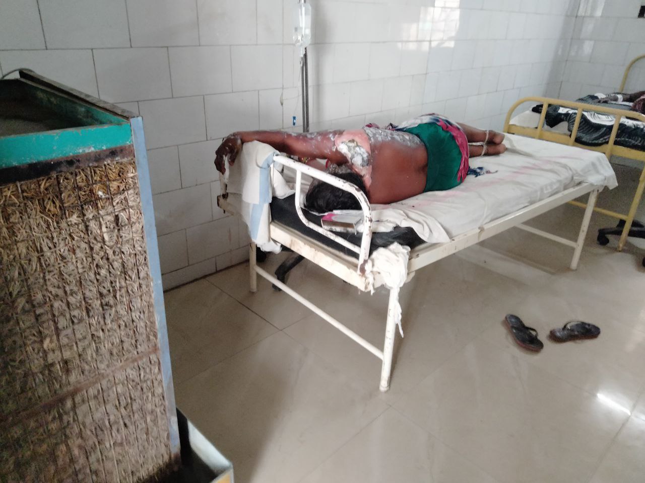The condition of burn patients in the biggest hospital of the district