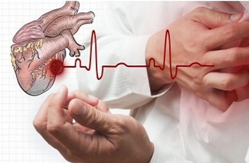 Heart attack : कोविड महामारी के बाद फलोदी में बढे हार्ट अटैक के मामले