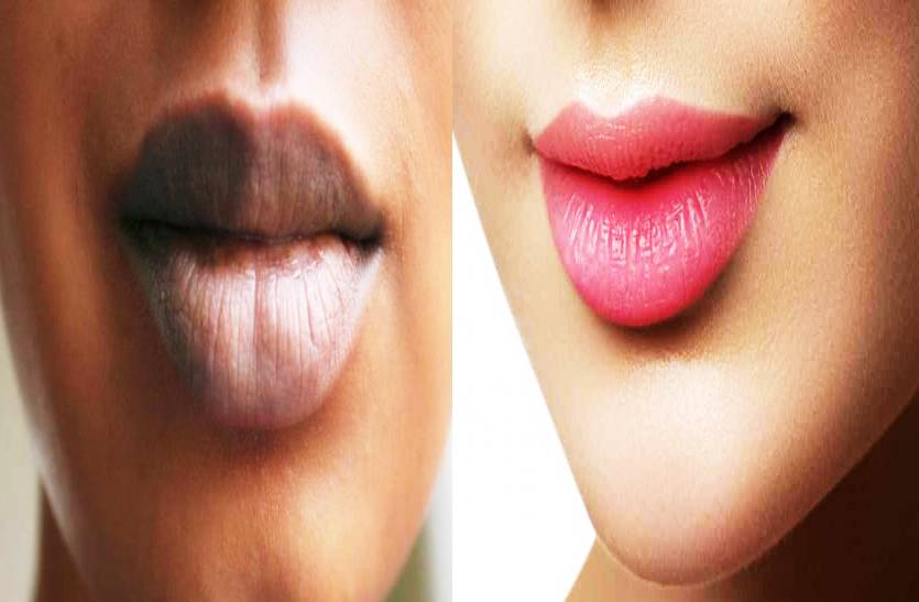home_remedies_to_dark_lips_treatment_keep_lips_soft_and_moisturized.jpg