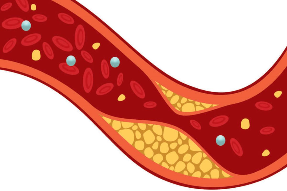 Cholesterol: अगर आप भी बढ़ते कोलेस्ट्रॉल लेवल को कम करना चाहते हैं, तो आज से ही अपनी डाइट में करें 4 इन चीजों को शामिल