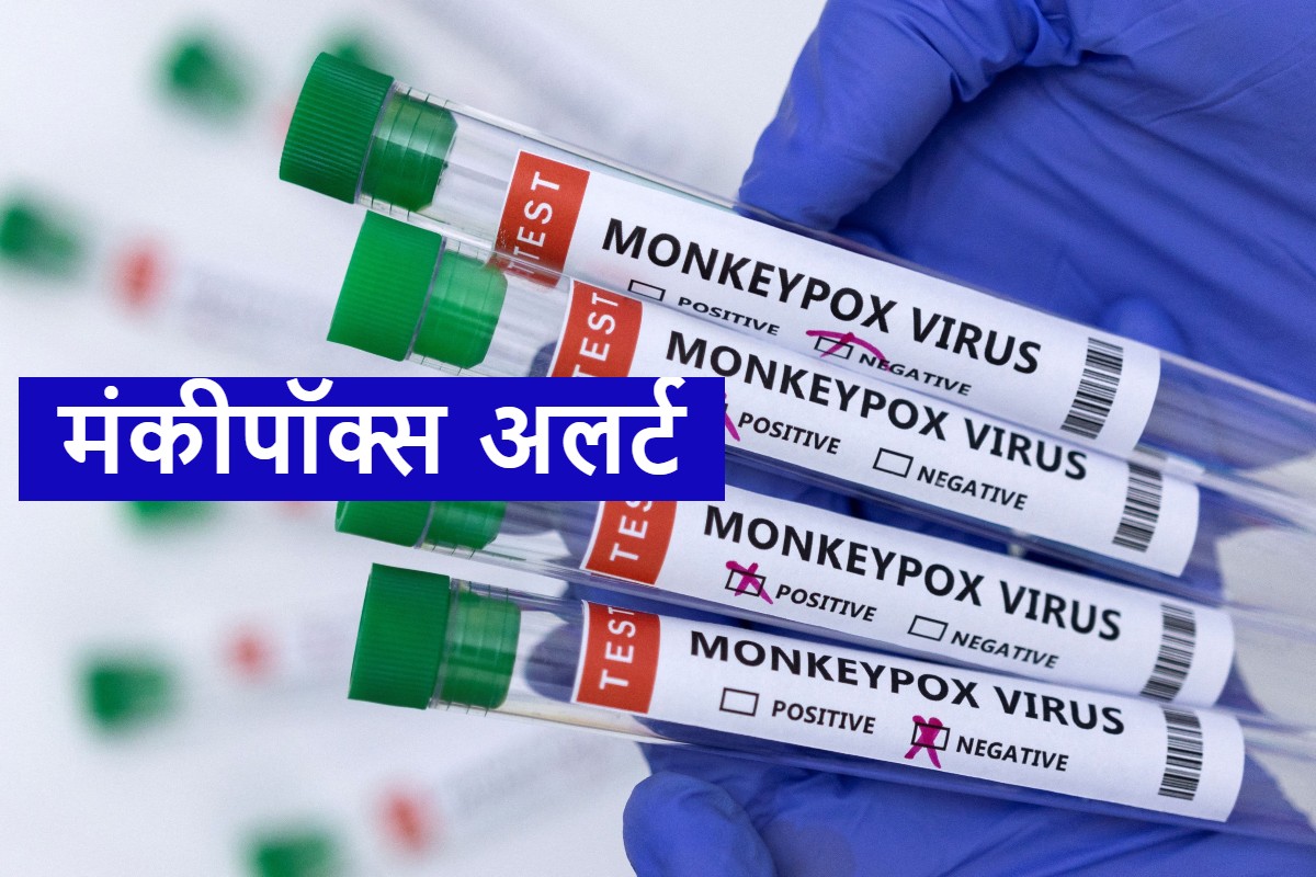 Monkeypox In India Suspect In Delhi With Foreign Travel History Admitted To LNJP Hospital 