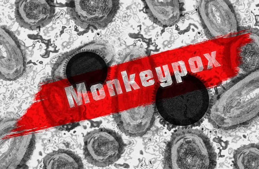 Monkeypox:  मेडिकल जर्नल द लैंसेट में Monkeypox को लेकर हैरान कर देने वाला खुलासा