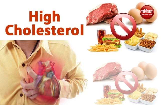 high cholesterol