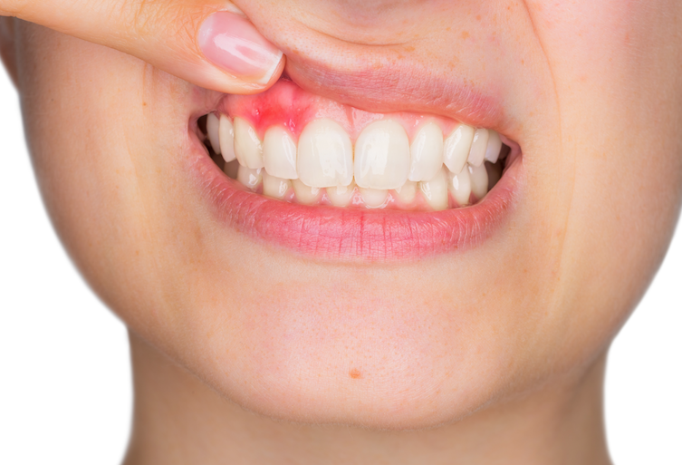 oral health alert teeth_-_copy.png