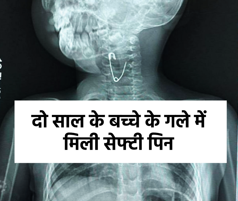 shahdol_pin.png