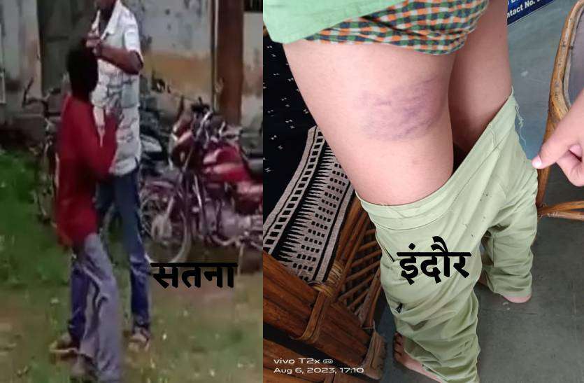 इंदौर और सतना में 8 वीं के बच्चों को टीचर और वार्डन ने बेरहमी से पीटा