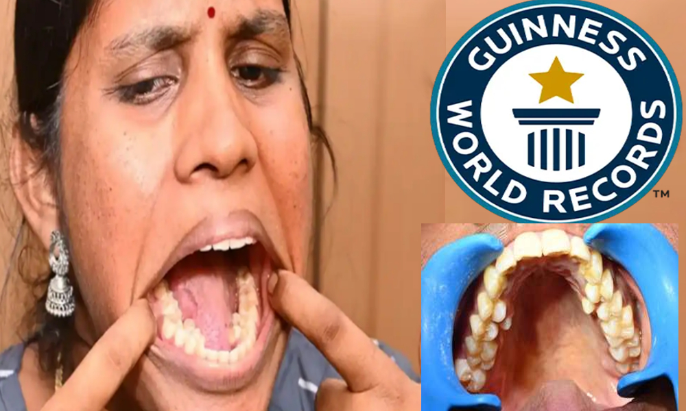 kalpana_balan_made_world_record_with_38_teeth_ii.jpg