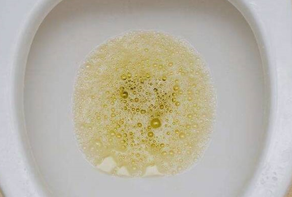 Protein in urine