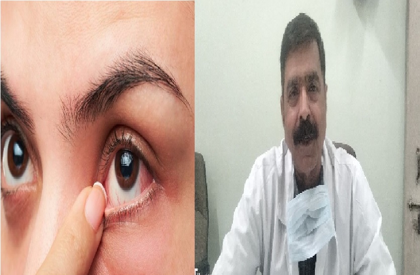होली पर केमिकल रंगों से बचे, अन्यथा जा सकती है आंखों की रोशनी : डॉ नगेंद्र शेखावत